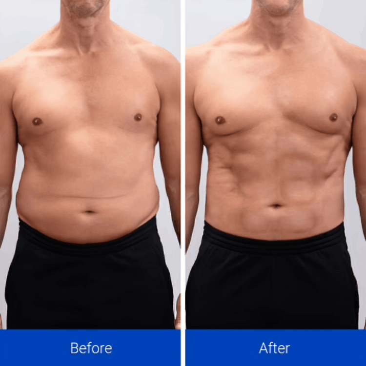 NavaMax ABS Stimulator customer~Greg - week 3 – New York, USA