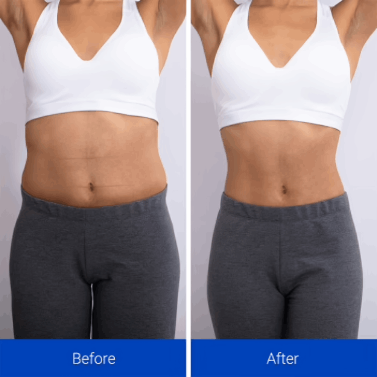 NavaMax ABS Stimulator customer~Alex - week 5 – Illinois, USA